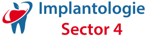 implant dentar din Bucuresti
