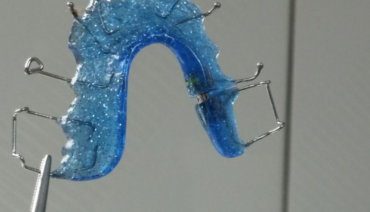 beneficii aparat dentar